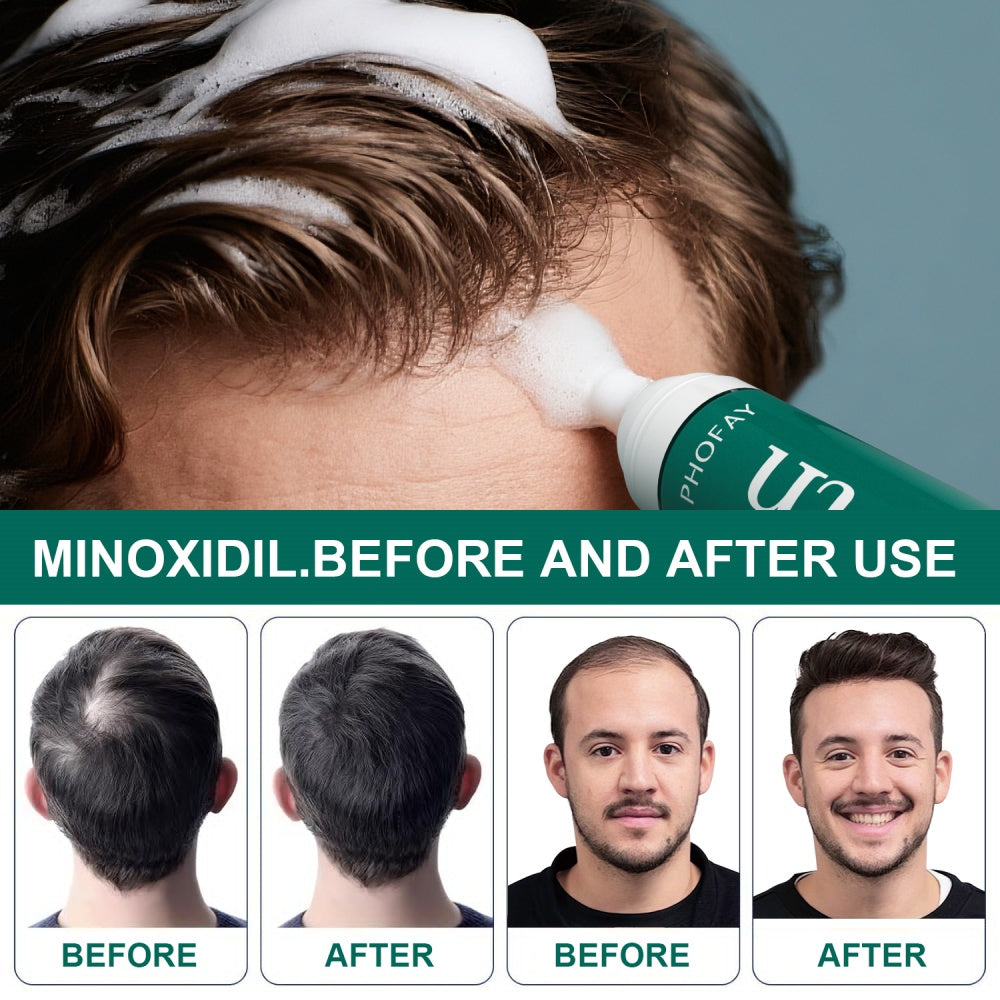 Minoxidil Anti-Hair Loss Mousse Koalakits36